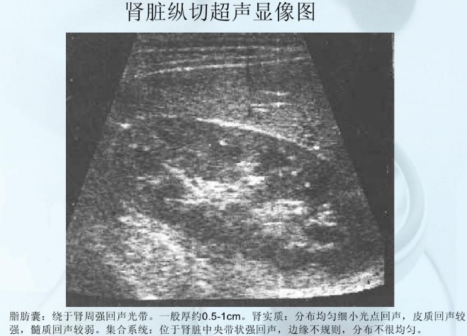 肾脏B超
